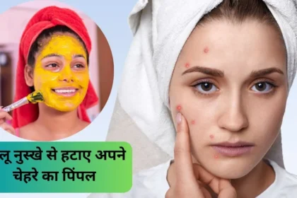 Face Pack For Pimples