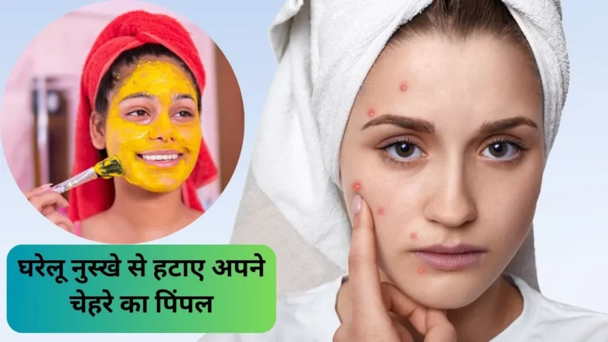 Face Pack For Pimples